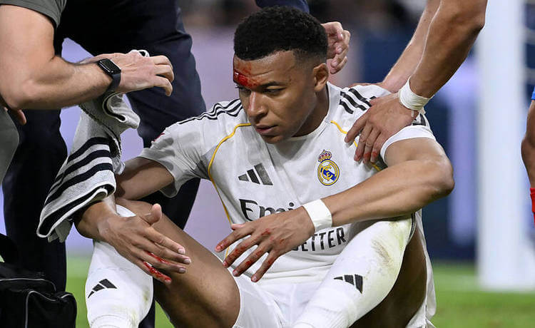 [xfvalue_artist] - [xfvalue_title]